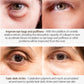 Crema contorno occhi: effetto lifting in 2 minuti 